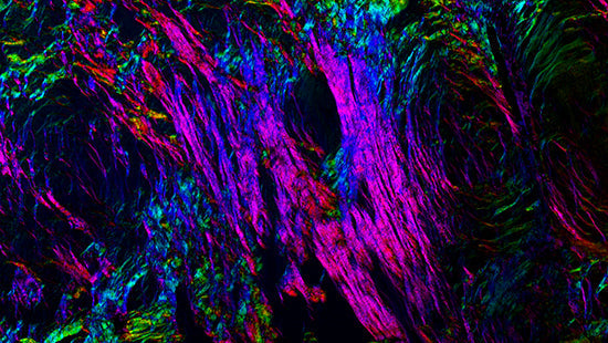Fluorescent microscopy of ovarian tissue highlighting the complex cellular architecture and structural remodeling that occurs during ovarian aging. Image courtesy of the Duncan Laboratory, Northwestern University Feinberg School of Medicine.