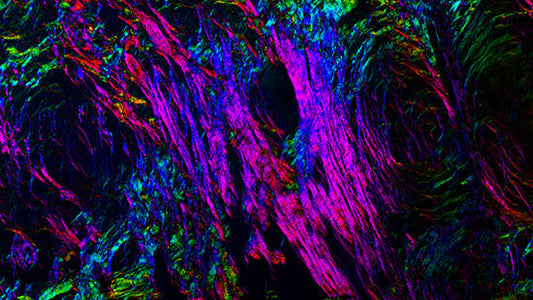 Fluorescent microscopy of ovarian tissue highlighting the complex cellular architecture and structural remodeling that occurs during ovarian aging. Image courtesy of the Duncan Laboratory, Northwestern University Feinberg School of Medicine.