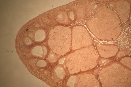 Microscopic cross-section of ovarian tissue showing follicles and cellular structure, illustrating ovarian inflammaging and the aging ovarian environment